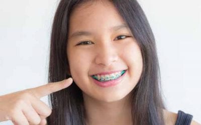 Help Your Kids Protect Their Teeth While Wearing Braces In Bloomfield NJ