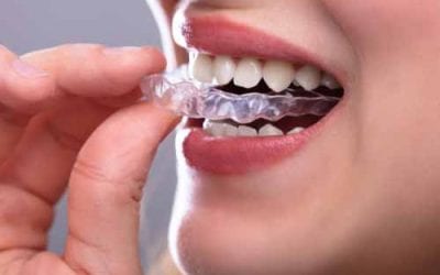 Why Invisalign is Perfect for Teens in Glen Ridge, NJ