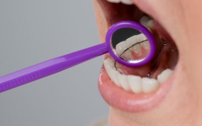 Preventing Gum Disease While Wearing Braces