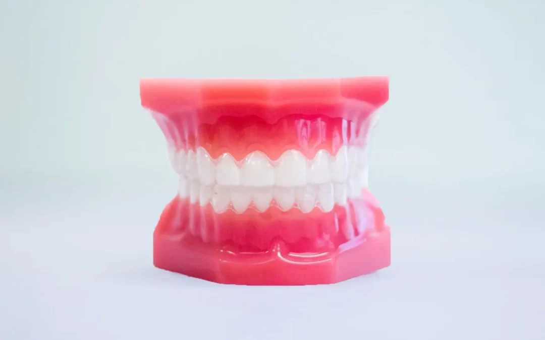 How Long does invisalign take?