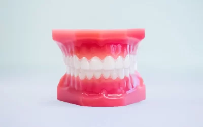 How Long does invisalign take?