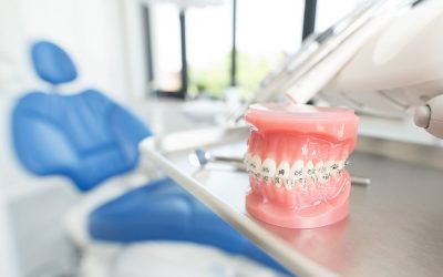 The Benefits of Orthodontic Treatment around Bloomfield, NJ