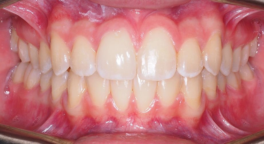 Joey O Final_Intraoral Center_03 Joey O Final Intraoral Center 03
