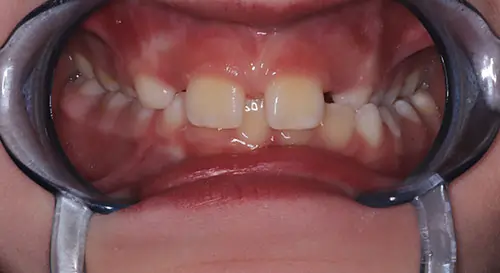 Phase 1 Patient 10 Before 2