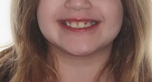 Phase 1 Patient 10 Before 1