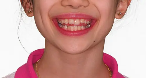 Phase 1 Patient 12 Before 1