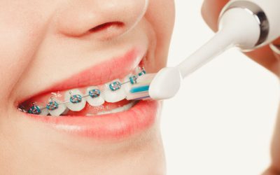 Blog - Learn More About Montclair NJ Orthodontist, Papasikos Orthodontics 1 How to Keep Your Teeth Clean During Orthodontic Treatment